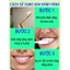 3 Ngày Sửa Chữa Kem Đánh Răng Kem Đánh Răng Kem Đánh Răng Bad Breath Kem Đánh Răng Kem Đánh Răng Kem Đánh Răng