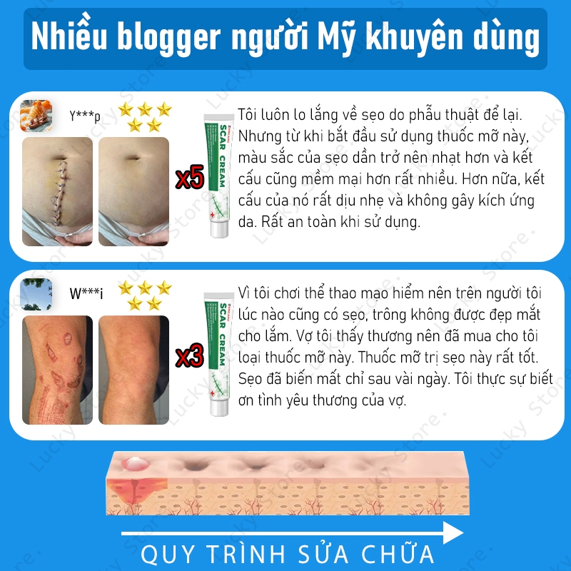 Kem loại bỏ sẹo hiệu quả sau 7 ngày cho sẹo cũ, sẹo phẫu thuật, giảm thâm mụn