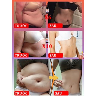 Tinh chất giảm béo và săn chắc, dầu massage định hình cơ thể, làm săn chắc và nâng, cải thiện đường béo phì, tinh chất thảo dược