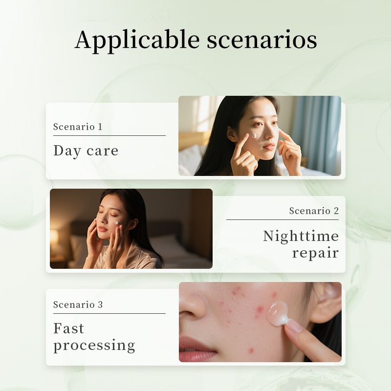 Kem phục hồi 24 giờ/Giảm mụn đầu đen/Giảm đỏ da/Dưỡng ẩm cho da/Nâng cao độ đàn hồi của da/Giữ ẩm da