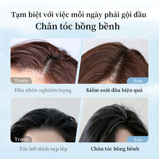 Dầu gội JKCK kiểm soát dầu và chống gàu hiệu quả 500ml