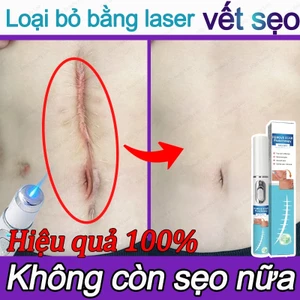 Bút laser nhập khẩu Nhật Bản loại bỏ sẹo tại nhà, thao tác dễ, không để lại dấu vết