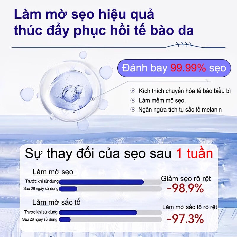 Bút laser nhập khẩu Nhật Bản loại bỏ sẹo tại nhà, thao tác dễ, không để lại dấu vết