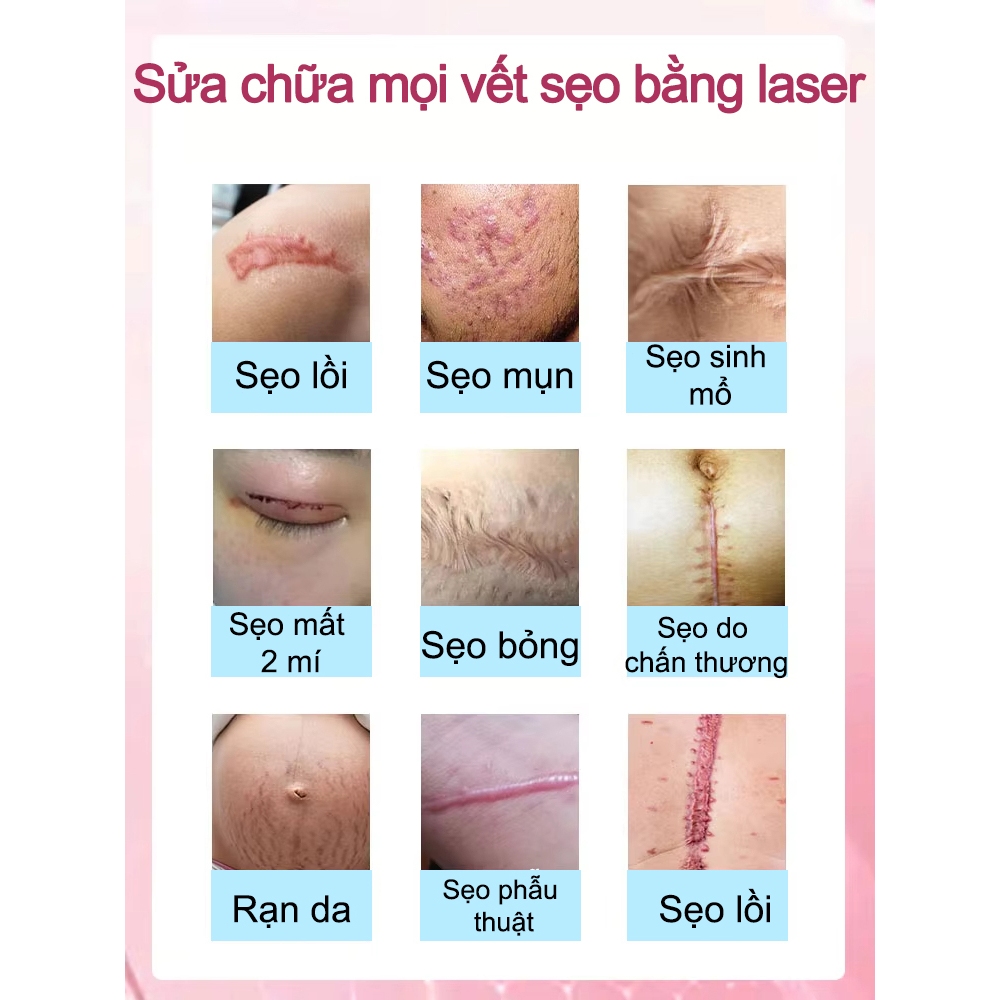 Bút laser nhập khẩu Nhật Bản loại bỏ sẹo tại nhà, thao tác dễ, không để lại dấu vết