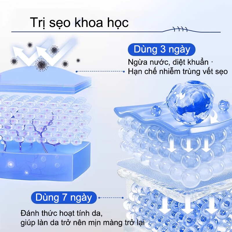 Bút laser nhập khẩu Nhật Bản loại bỏ sẹo tại nhà, thao tác dễ, không để lại dấu vết