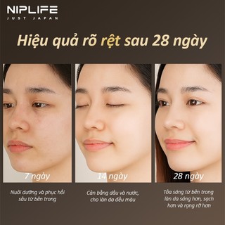 Máy massage mặt NIPLIFE EMS sóng tần số vô tuyến xóa nếp nhăn