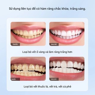 Kem đánh răng làm trắng, loại bỏ vết ố cà phê, ngăn ngừa sâu răng, giảm hôi miệng, nhập khẩu Nhật Bản