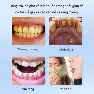Kem đánh răng làm trắng, loại bỏ vết ố cà phê, ngăn ngừa sâu răng, giảm hôi miệng, nhập khẩu Nhật Bản