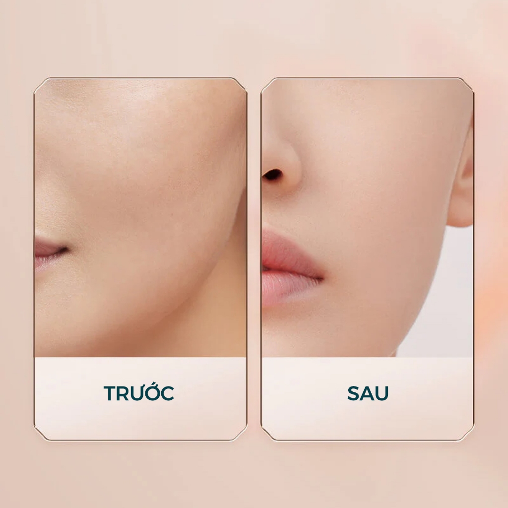 【Yến Muốn Đẹp Livestream】Florasis ( Hoa Tây Tử) Phấn Nén Lì Mịn Yurong Airbrushed – Finish Lì, Mịn & Lâu Trôi 9g