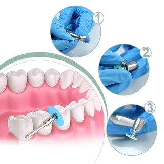 10/40 Chiếc Đánh Bóng Răng Đĩa Giữ Cần Mandrel Soflex Flexi Đĩa RA Vỏ Làm Trắng Răng Chất Liệu Nha Khoa Dụng Cụ