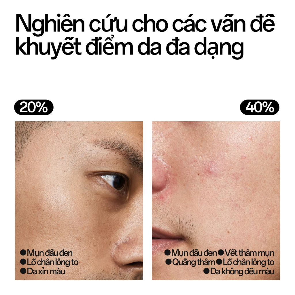 ApexFlow Kem Nền Nâng Tone - Làm Sáng Tự Nhiên, Kiềm Dầu Thu Nhỏ Lỗ Chân Lông, Dành Cho Nam Giới 30g