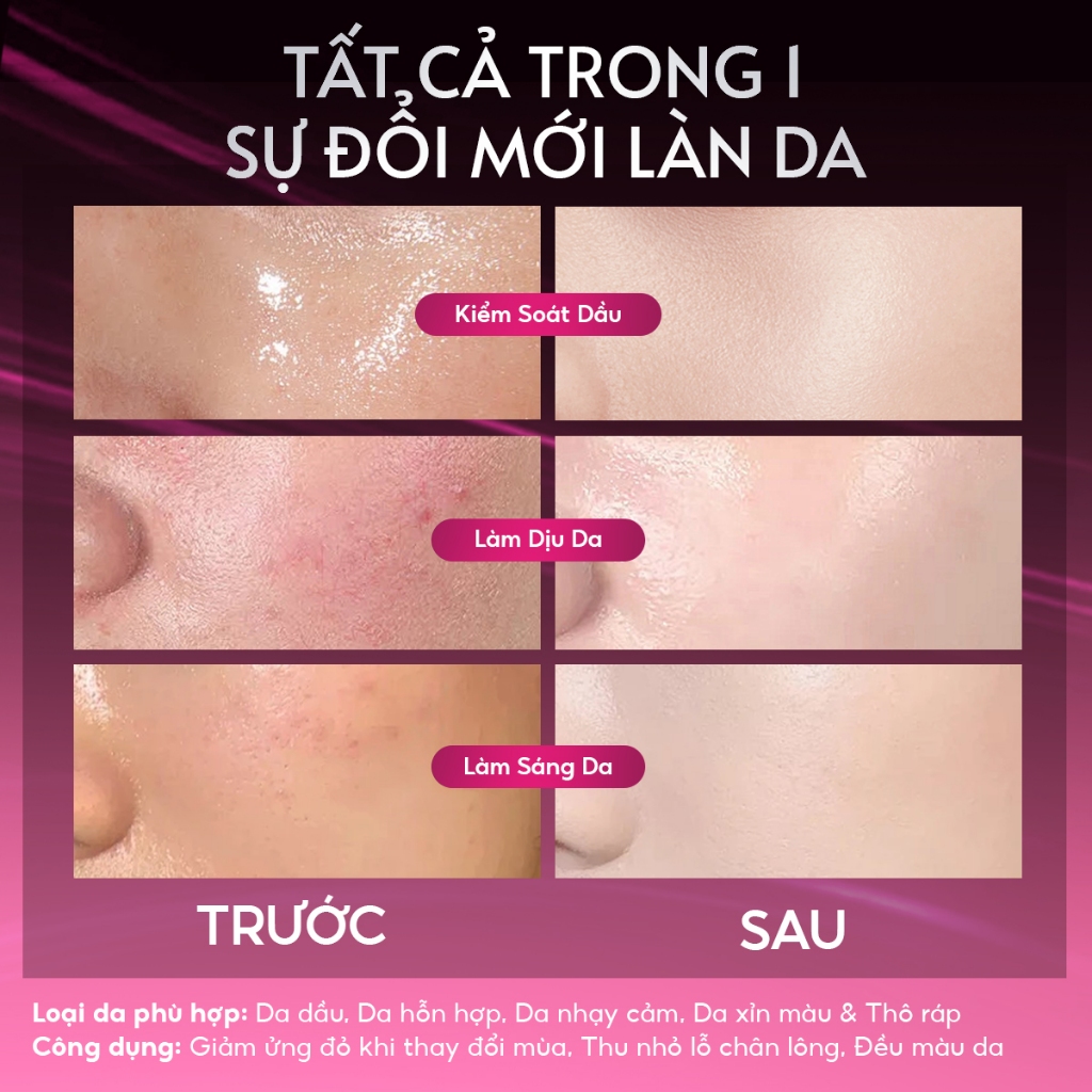 Serum Red Peel Tingle Cyeecare Tinh Chất AHA + BHA Peeling Da Giảm Mụn phục hồi tái tạo da sáng da 20g