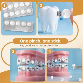 60 Cái / hộp Sáp Nha Khoa Cho Nẹp Kẹo Cao Su Di Động Hương Vị Trái Cây Dạng Hạt Bảo Vệ Sáp Chấm Hộp Gói Cá Nhân