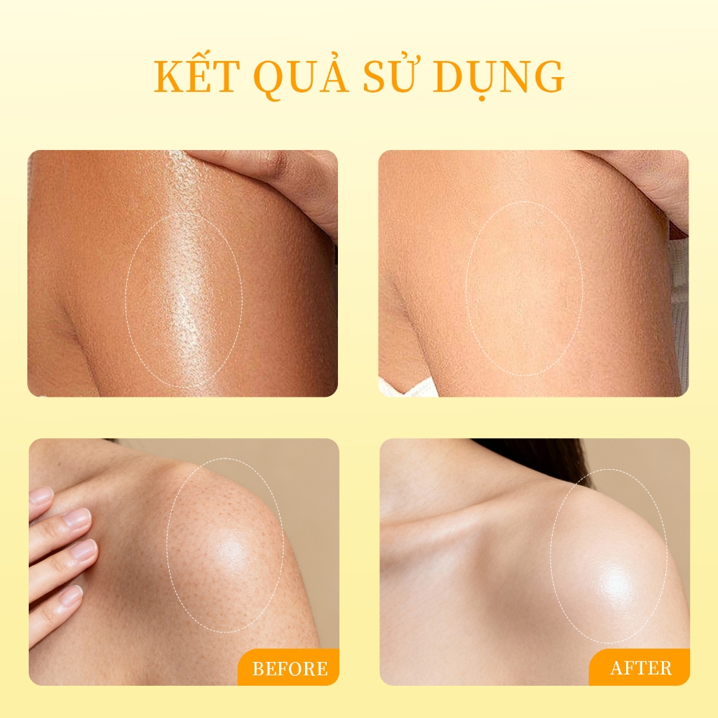 Body Oil Dầu dưỡng thể Vitamin C 120ml,Làm săn chắc da,làm sáng da,làm mờ nếp nhăn,thấm nhanh.