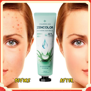 Gel dưỡng trắng da và dưỡng ẩm Aloe Vera Gel dưỡng ẩm thảo dược tự nhiên Kem dưỡng da mặt Loại bỏ mụn trứng cá sau khi tắm nắng Gel lô hội Chăm sóc da làm đẹp ✷ ❈ 🇾