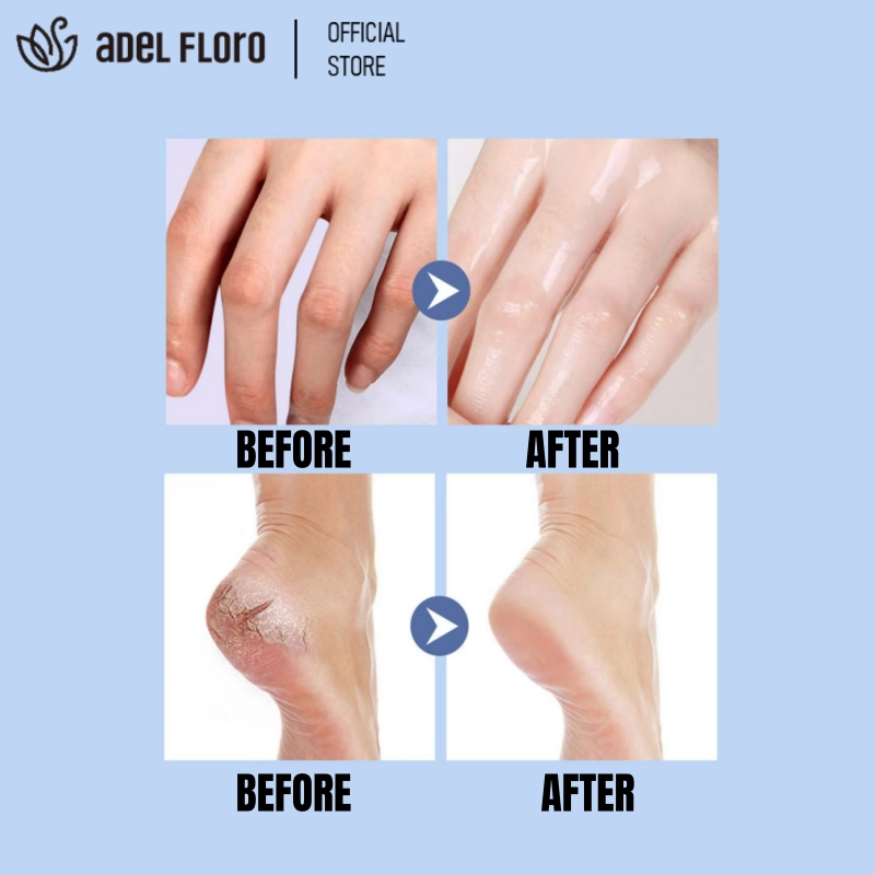 Kem Vaseline Adel Dưỡng Ẩm Sâu Chăm Sóc Da Chân Tay Khô, Môi Nứt Nẻ - Dưỡng Thể Toàn Thân