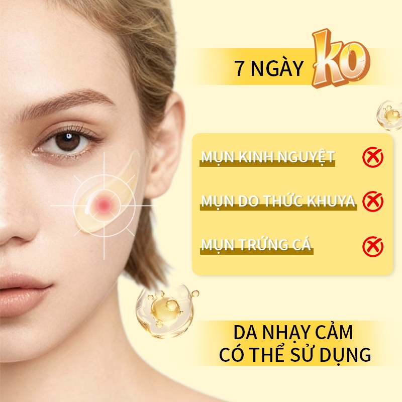 【SevonStory ⑦】Tinh chất tạo màng giảm mụn, làm sáng da, kiềm dầu và dịu nhẹ làm da. Phù hợp với da dầu, da mụn, da nhạy cảm, giúp thu nhỏ lỗ chân lông, hỗ trợ giảm viêm, mang lại cảm giác tươi mát không gây bết dính