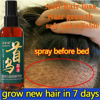 Xịt mọc tóc 100ML ngăn ngừa rụng tóc, chống hói đầu cho nam nữ
