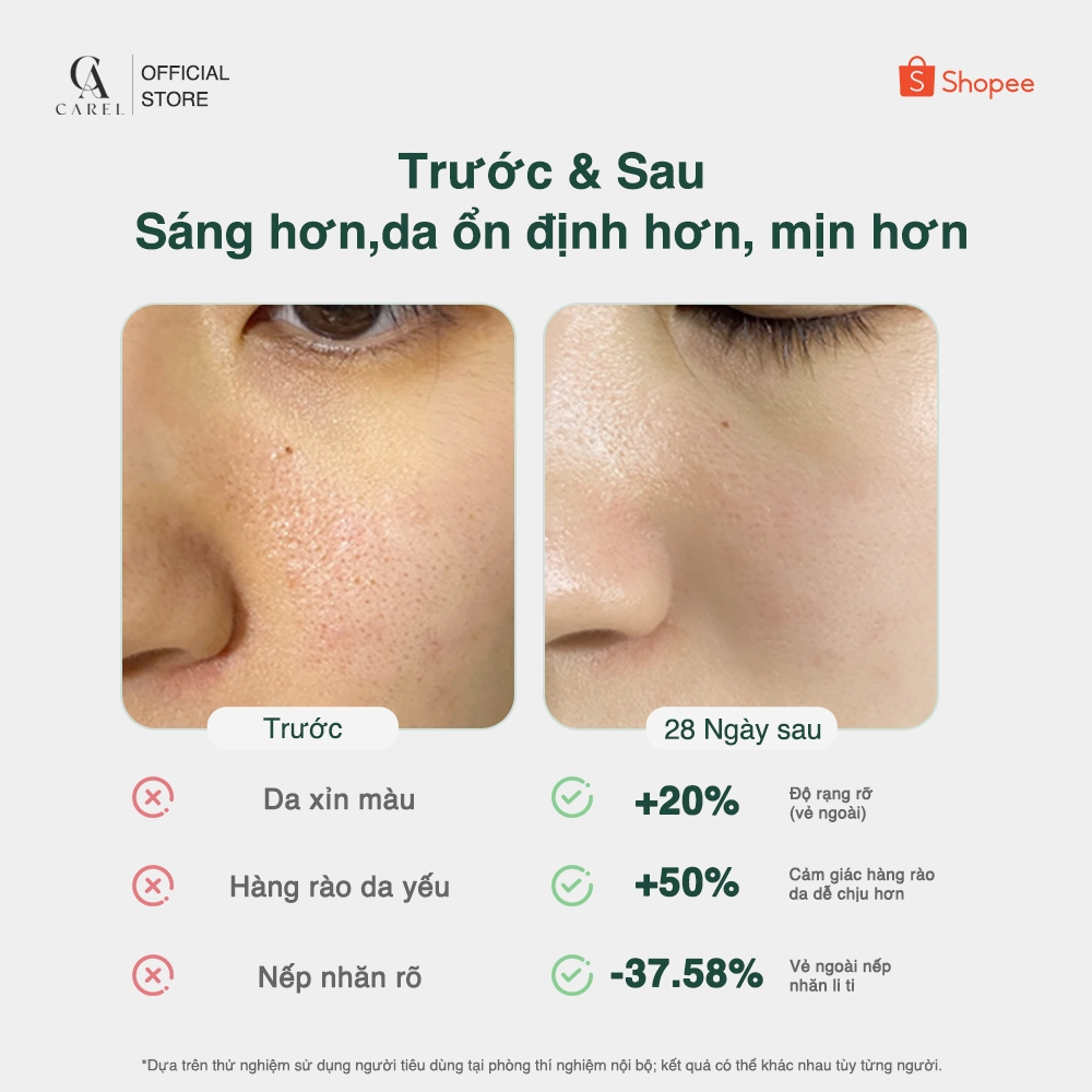 Sử dụng Serum Peptide Linh Chi Hỗ Trợ Phục Hồi Da trong đời sống