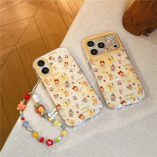 IPhone 17 Pro max 16 Pro Star Baby họa tiết chất liệu TPU IMD xử lý vỏ điện thoại in hai lớp
