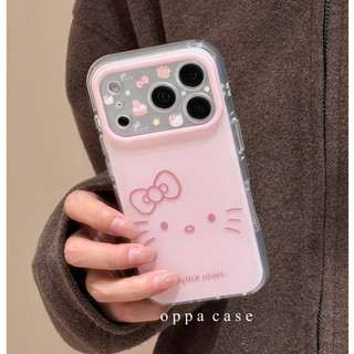 Hàn Quốc Ins Hoạt Hình Dễ Thương Màu Hồng Hellokitty Mèo Bảo Vệ Toàn Ống Kính Ốp Điện Thoại Cho iPhone 17Promax 17Pro 15 16 Promax Chống Sốc Hai Lớp imd Vỏ Ngọt Nữ Tính