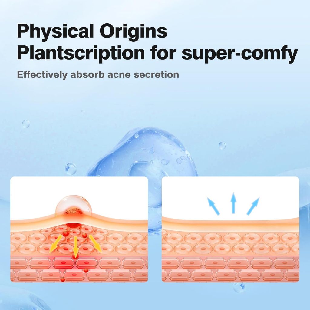 Miếng dán mụn QUSTERE 400—được làm từ chất liệu hydrocolloid, giúp thấm hút dịch tiết và bảo vệ vùng da bị mụn. Sản phẩm hỗ trợ giảm mụn, chứa tinh dầu tràm trà cùng axit salicylic, và phù hợp với mọi loại da.