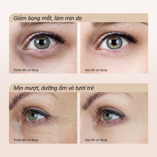 Kem dưỡng mắt không chứa NIPLIFLIFE