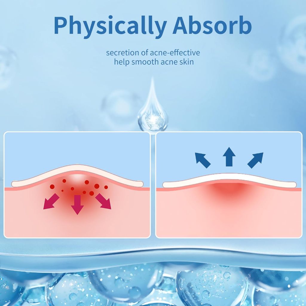 Miếng dán Hydrocolloid QUSTERE che mụn vô hình, chống thấm nước, bảo vệ da, phù hợp hầu hết loại da