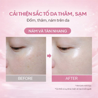 Kem Retinol chống lão hóa SKNB - Làm mờ vết thâm, giảm nếp nhăn và siết chặt lỗ chân lông Kem chống lão hóa 50g 3 hộp