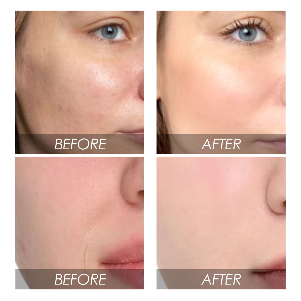 EELHOE Bơ / Dưa Hấu Hydrating Facial Serum – Làm Sáng Da, Giảm Nếp Nhăn, Tinh Tế Lỗ Chân Lông, Công Thức Tự Nhiên Cho Mọi Loại Da 30ml