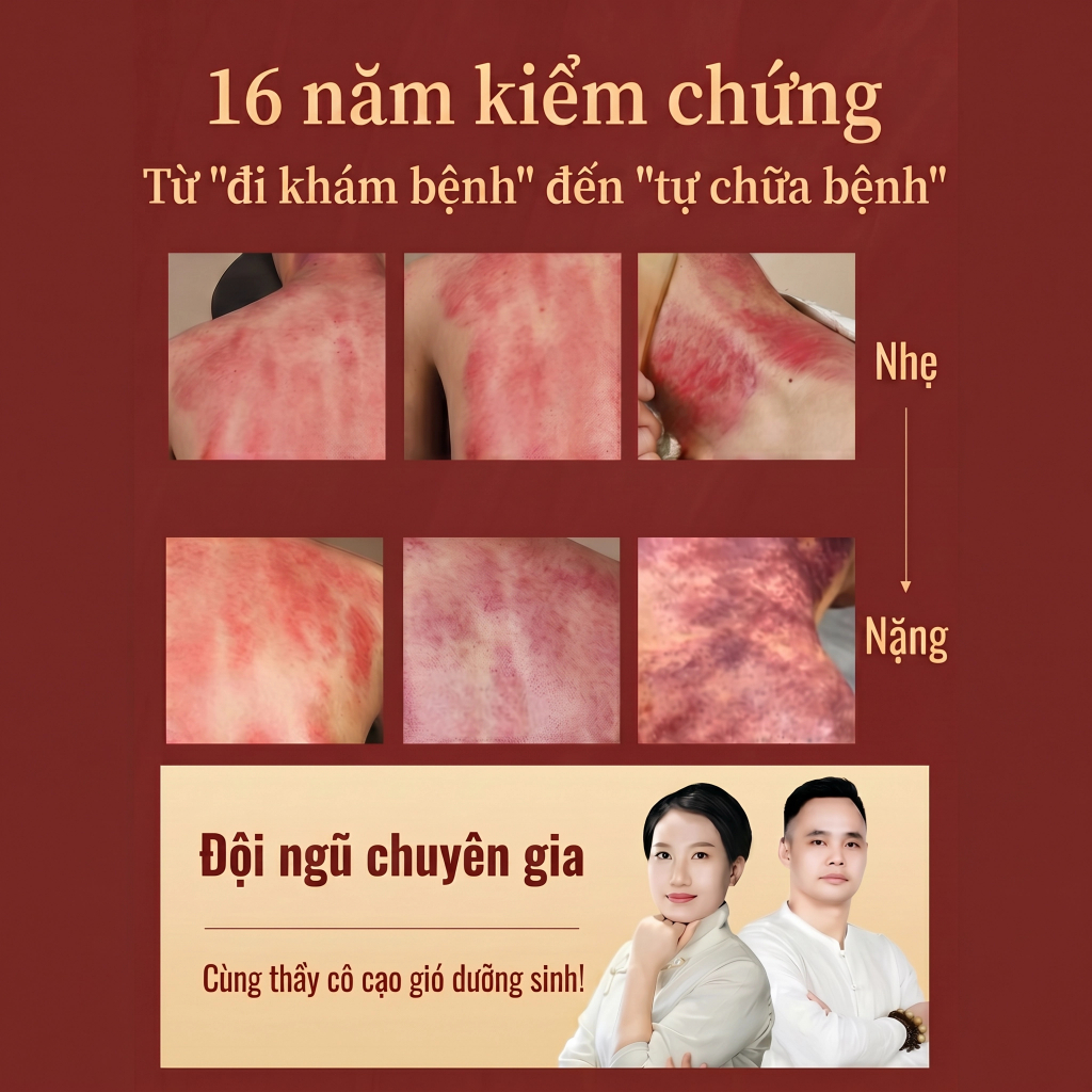 Tất Cả Đồng Tấm Cạo Ban Chính Hãng Đồng Nguyên Chất Làm Toàn Thân Đa Năng Hộ Gia Đình Hổ Talisman Cạo Bianstone Lưng Cột Sống Cổ Tử Cung Dev