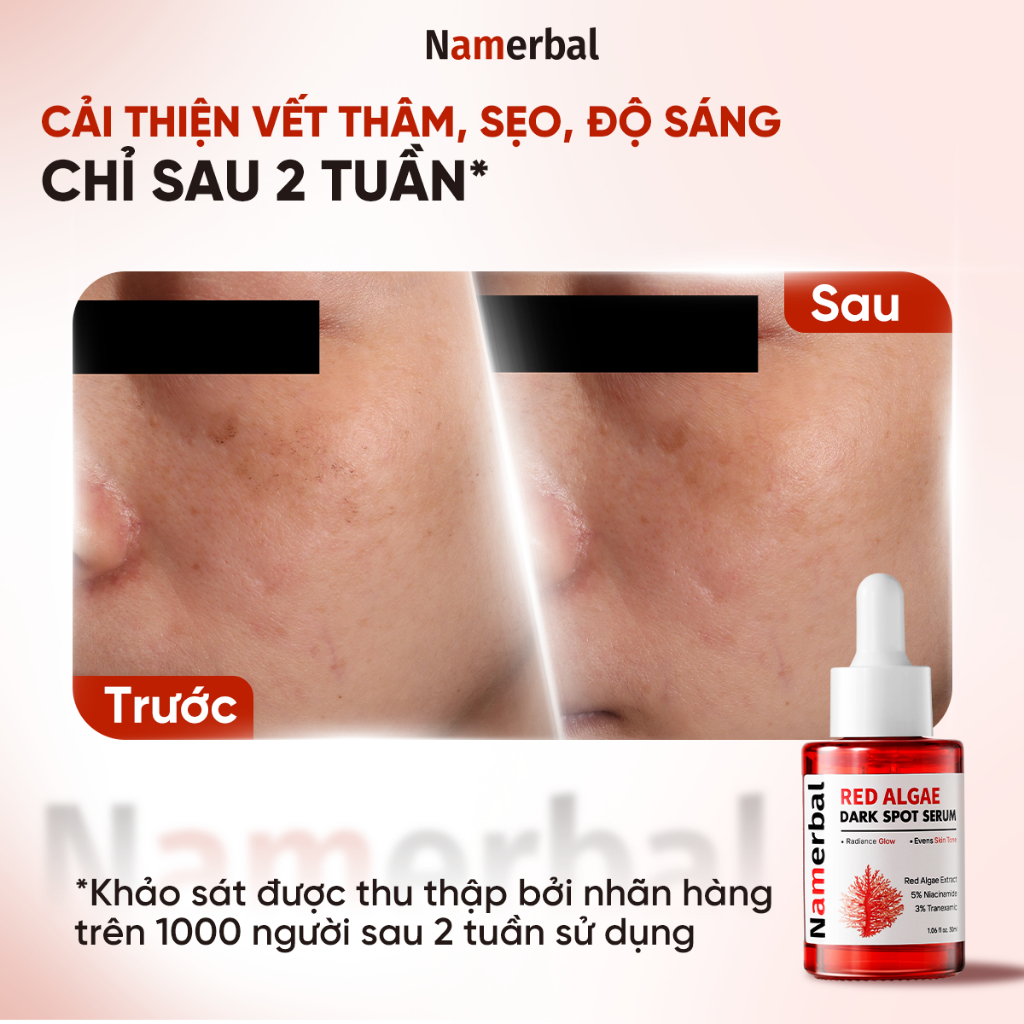 [LIVE] Serum Tảo Đỏ Namerbal Giúp Làm Sáng Da Và Làm Mờ Sẹo Mụn Astaxanthin + Niacinamide 5% + Axit Tranexamic 3% 30ml | BigBuy360 - bigbuy360.vn