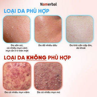 [LIVE] Toner Dịu Da, Cân Bằng Dầu Nhờn, Sáng Da Namebal Axit Hyaluronic + PHA + Niacinamide + Astaxanthin