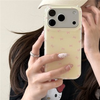 Ốp điện thoại xử lý IMD cho iPhone 17 Pro max Knot Pattern