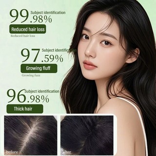 Herbal Platycladi Usman cỏ handmade dầu gội xà phòng Làm mới và xả khỏe mạnh Chống loại bỏ tóc Nuôi dưỡng sạch sẽ