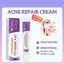 Kem Hỗ trợ giảm mụn axit Azelaic 12% Giảm mụn trứng cá cho da mặt Chống mụn trứng cá với Niacinamide & Vitamin C (♧ ❈ ❈ ❈)