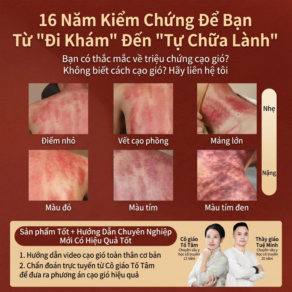 Xẻng cạo gió bằng đồng đỏ — Chế tác hoàn toàn từ đồng đỏ nguyên chất, dùng để massage, cạo gió, thông kinh lạc, dụng cụ cân cơ, sử dụng toàn thân.