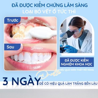 DR.ville kem đánh trắng răng Kem đánh răng làm trắng răng sensodyne phục hồi và bảo vệ 100ml