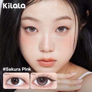 [ 1 chiếc lens ] Kính áp tròng Kilala màu nâu Yay Radiowave Black/Wild Fruit Brown/Sakura Pink lens cận 6 tháng DIA 14.2-14.5mm có độ (0-7)