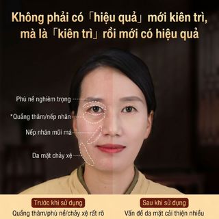 que cạo gió bằng đồng làm đẹp da mặt điểm chân điểm tai đầu dò massage đầu dụng cụ massage kim loại bằng thép không gỉ