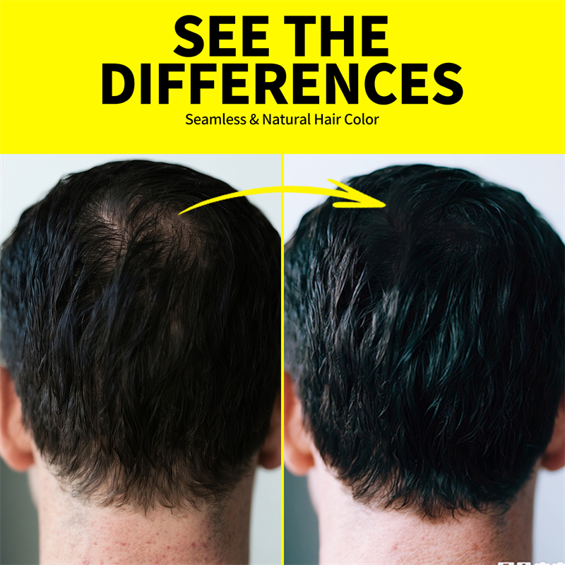 SEVICH Hairline Shadow pen không thấm nước sửa chữa đường viền tóc lấp đầy bột bóng tóc 2g