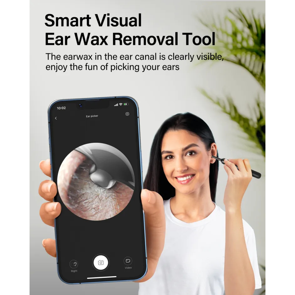 Máy làm sạch tai thông minh Bebird XLIFE X0 SE