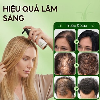 DR.ville Xịt Mọc Tóc Serum Dưỡng Tóc Kích Mọc Tóc Sịt Mọc Tóc Nhanh Kích Thích Mọc Tóc 50ML