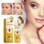 Ximonth Tag Recede Bee Venom Repair Spray 20ml, Xịt loại bỏ mụn cóc & thẻ da nâng cao cho mọi loại da