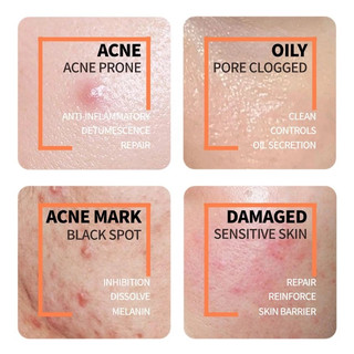 Ordinary Brightening Set For Remover Dark Spots Whitening Facial Moisturizer (Niacinamide 10% + Ascorbic Acid 8%)