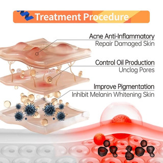 Ordinary Brightening Set For Remover Dark Spots Whitening Facial Moisturizer (Niacinamide 10% + Ascorbic Acid 8%)