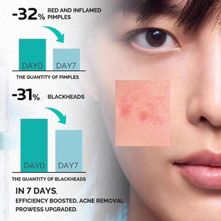 Ordinary Brightening Set For Remover Dark Spots Whitening Facial Moisturizer (Niacinamide 10% + Ascorbic Acid 8%)