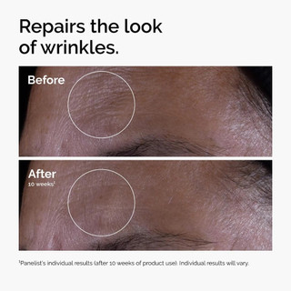 Ordinary Serum Retinol chăm sóc da mặt chống lão hóa