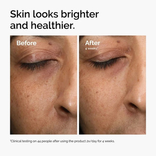 Ordinary Serum Retinol chăm sóc da mặt chống lão hóa