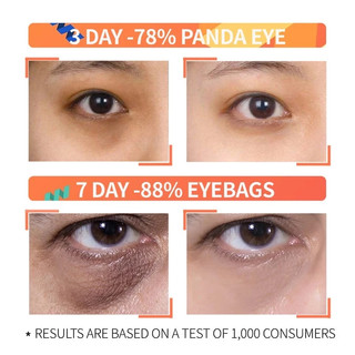 Ordinary Serum mắt làm giảm quầng thâm và chống lão hóa